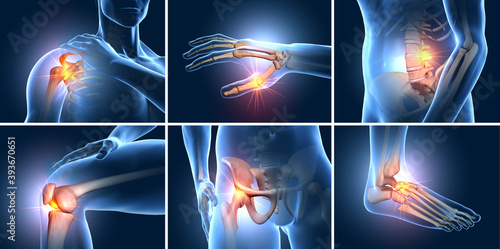 Painful joints. Shoulder joint, knee joint, wrist joint, hip joint, ankle joint, vertebral joint. Medical 3D illustration photo