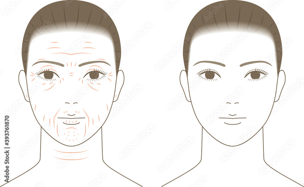 女性の顔と加齢によるシワ。