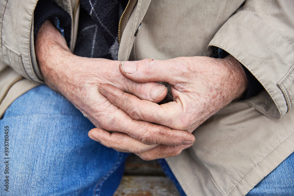 An elderly man's hands are clasped together on the lap of a man sitting on a bench. Worker hands, dry skin of hands.  Selective focus, background blur.