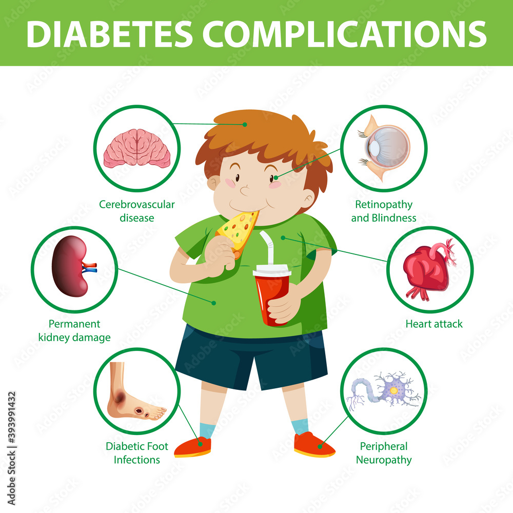 Diabetes complications information infographic Diabetes complications information infographic