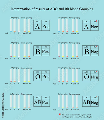 Interpretation of results of ABO and Rh blood grouping by tube test in laboratory