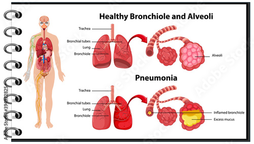 Healthy and unhealthy of human lungs