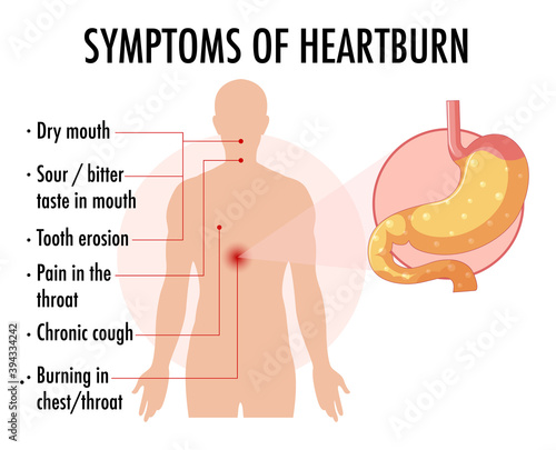 Symptoms of heartburn information infographic