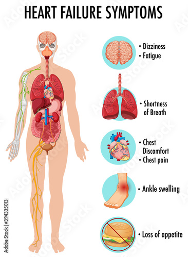Heart failure symptoms information infographic