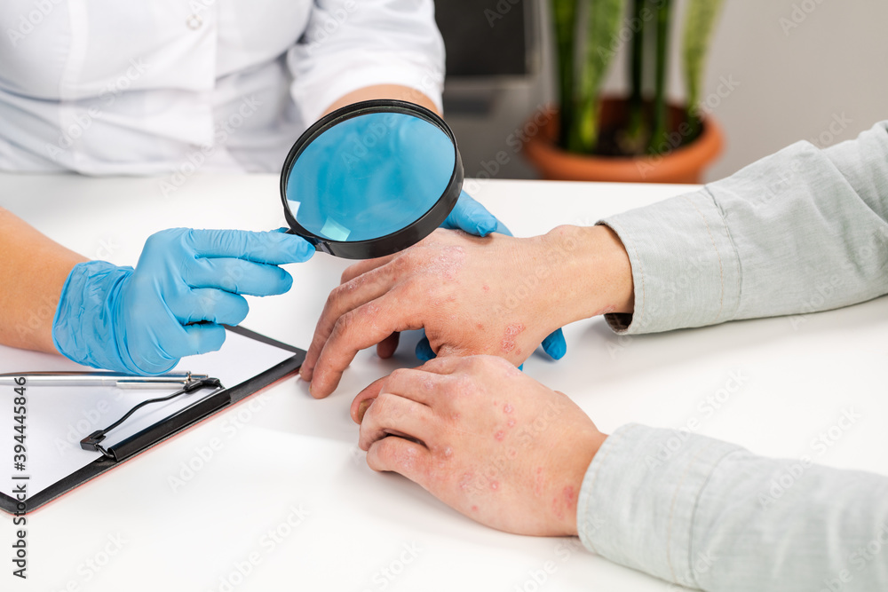 Foto Stock A dermatologist wearing gloves examines the skin of a sick