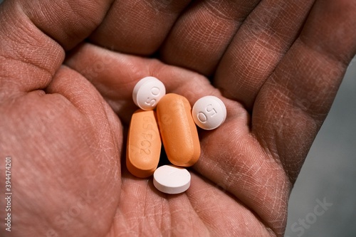 white and orange antiretroviral therapy pills for treatment of HIV in hand. Dolutegravir, Abacavir, Lamivudine. World AIDS Day concept. Healthcare and medicine. Tablets and medication. Vertical image.