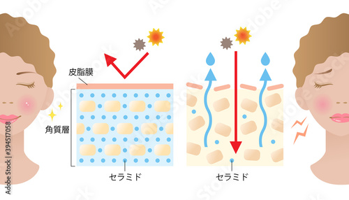 セラミド　乾燥肌　断面図　女性　ビフォアアフター