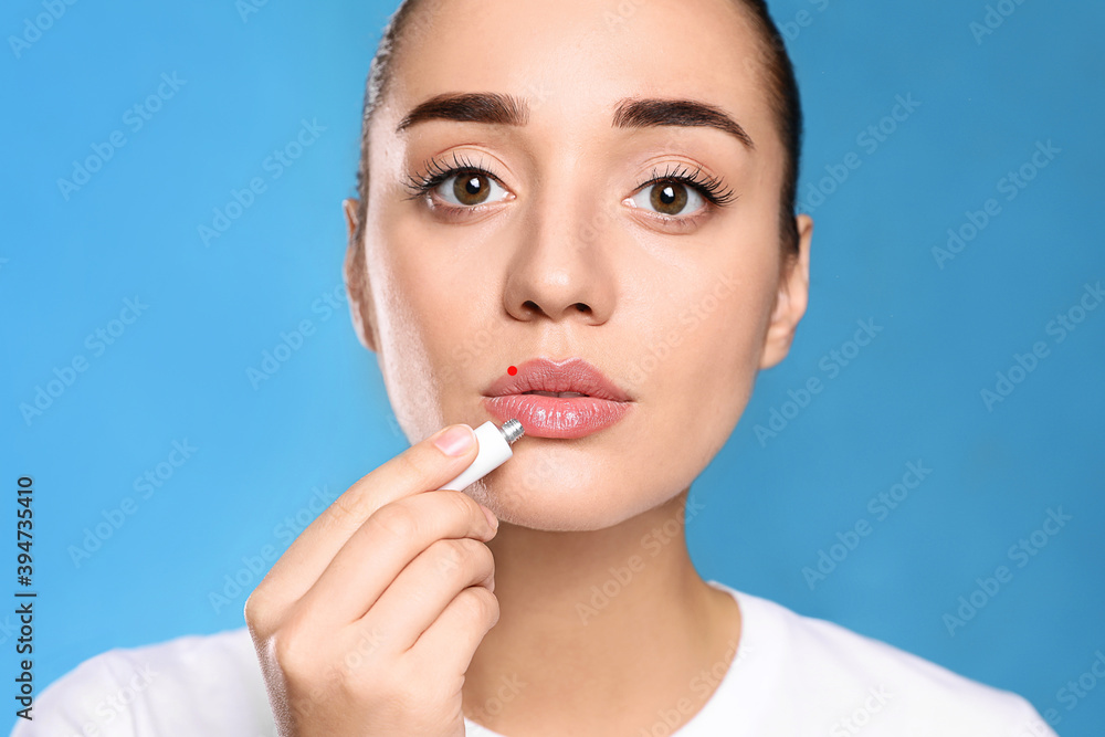 Woman with herpes applying cream onto lip against light blue background Woman with herpes applying cream onto lip against light blue background