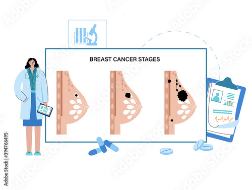 Breast disease concept
