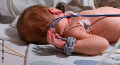 Premature baby hand with a premature infant pulse oximeter, selective focus. Newborn is placed in the incubator, baby born prematurely. Neonatal intensive care unit photo