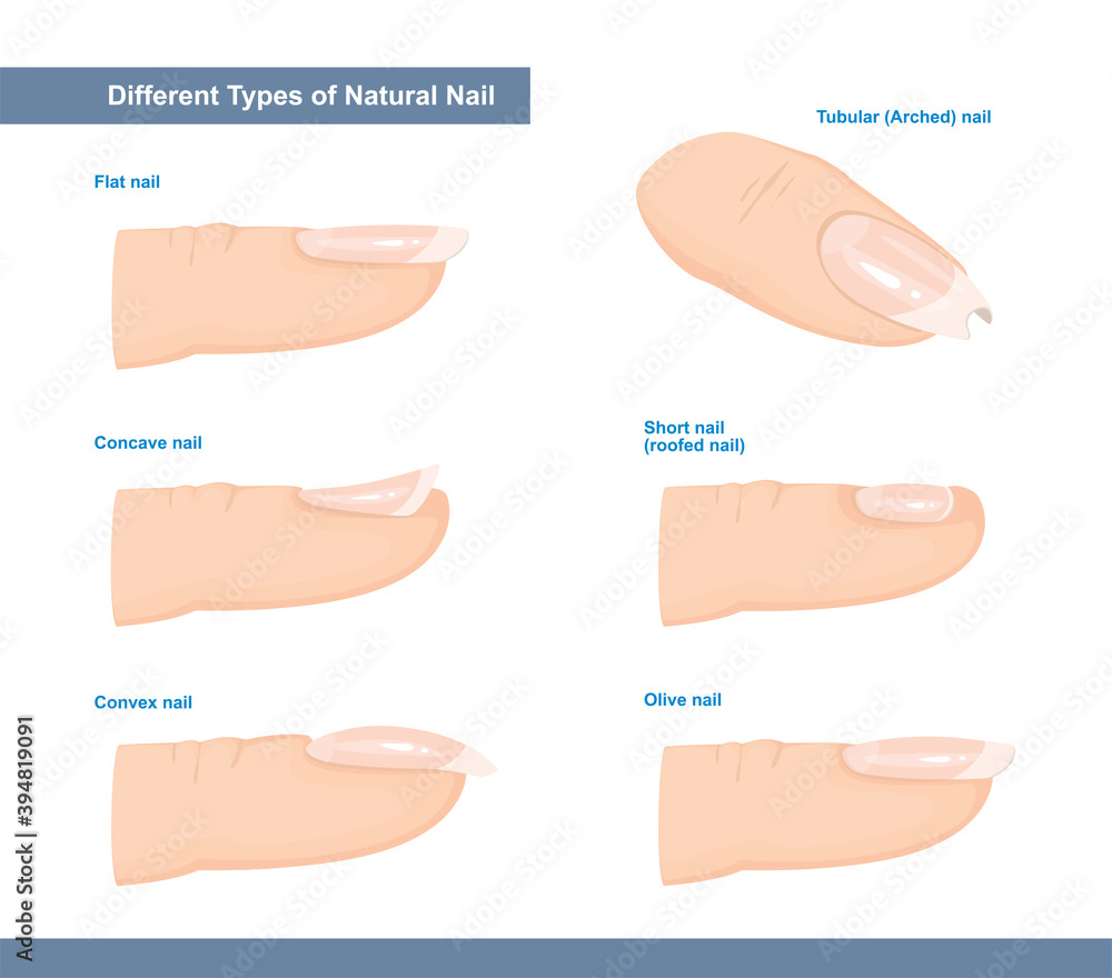 Different Types of Fingernail. Normal, Short, Roofed, Tubular, Arched,  Flat, Convex and Concave Nails. Nail Extension Guide. Vector Illustration  Stock Vector | Adobe Stock