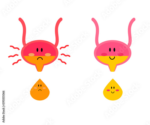 Bladder on a white background. Cystitis. Vector. 