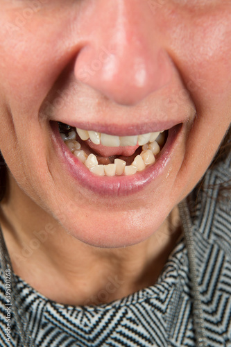 Close up of healthy teeth of young woman. Dental health care. Hygiene teeth. Dentistry