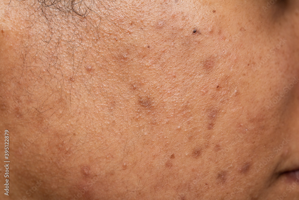 Dark spots and skin problems and itching Skin disease freckles on the skin Dark spots and skin problems and itching Skin disease freckles on the skin