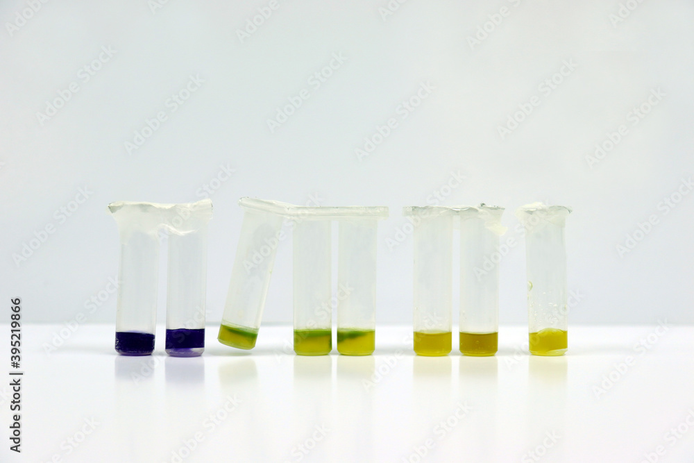 Foto de Micro centrifuge tubes of samples for testing antibiotic in beef or meats by using test