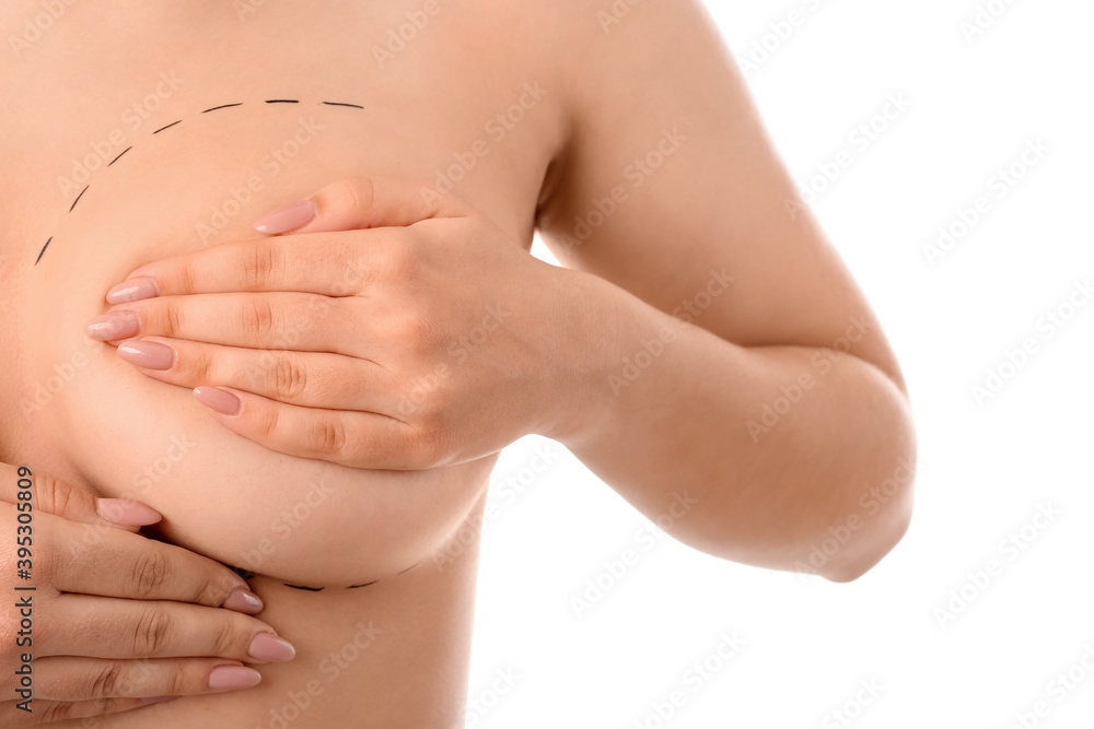 Woman with marks on her chest against white background. Concept of breast augmentation Woman with marks on her chest against white background. Concept of breast augmentation