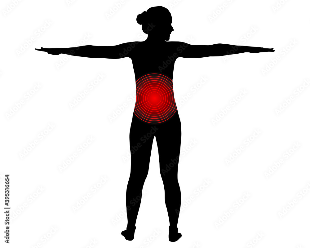 Rückansicht Frau mit Symbol für Rückenschmerzen