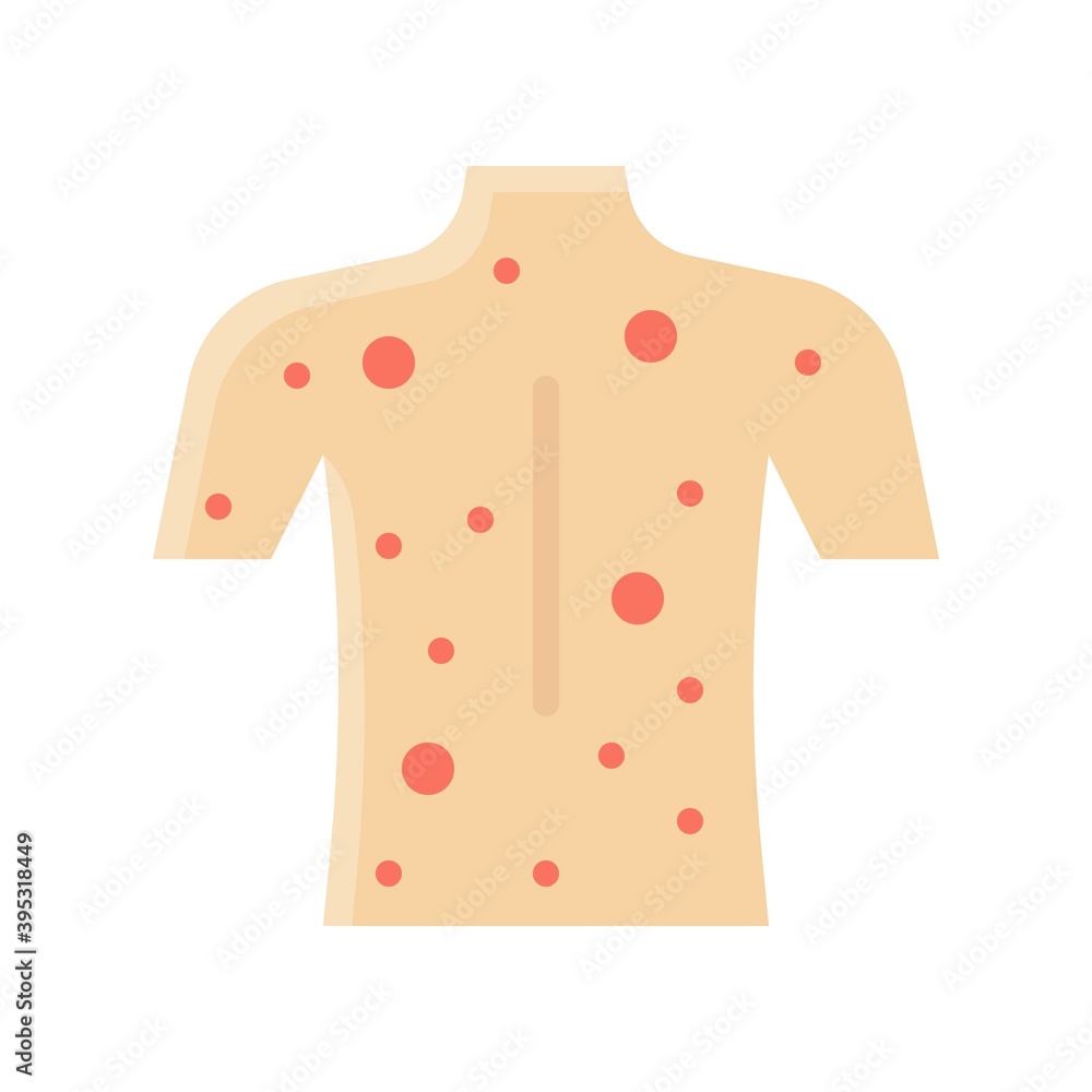 sickness and disease related patient with skin problem vectors in flat style,
