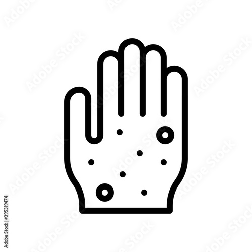 Obraz na płótnie sickness and disease related bacteria on patient hand vectors in lineal style, w salonie