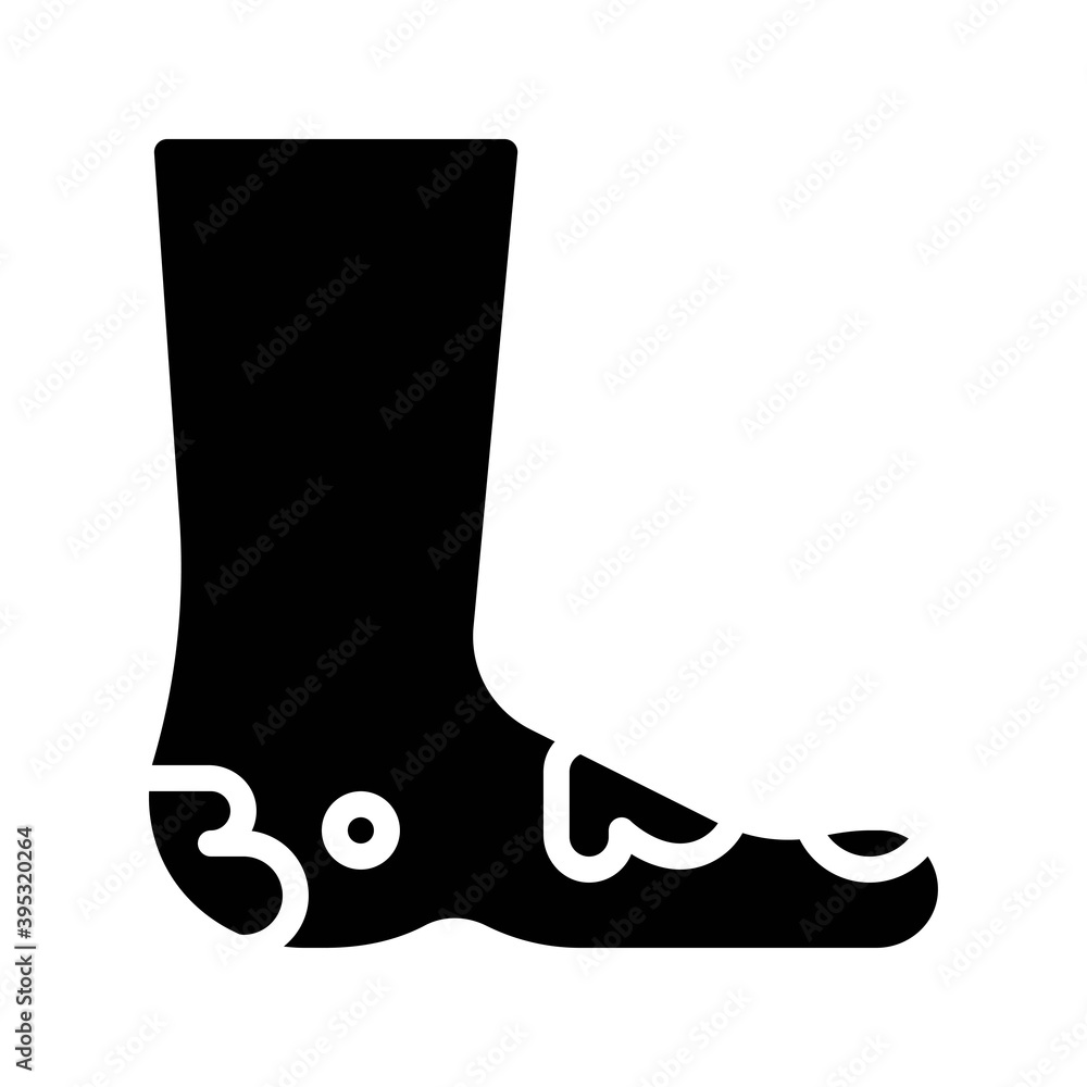 sickness and disease related patient with feet pain problem vectors in solid design,