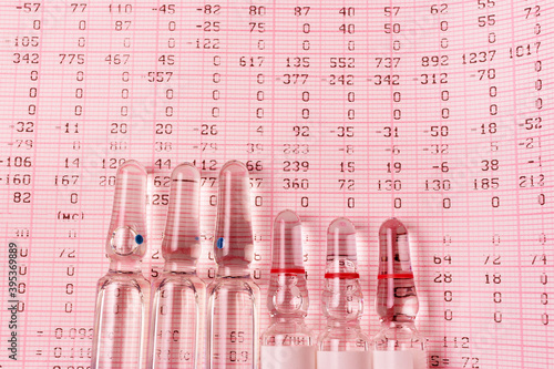 Ampoules on the ECG data tape