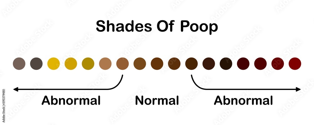 Normal abnormal