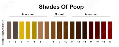Shades color of poop. Human feces color strip. Healthy concept. Normal and abnormal value scale. Vector