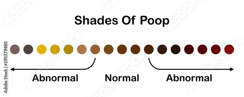 Human feces color. Shades color of poop. Normal and abnormal value scale. Healthy concept. Vector