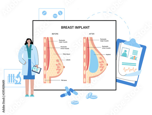 Breast disease concept