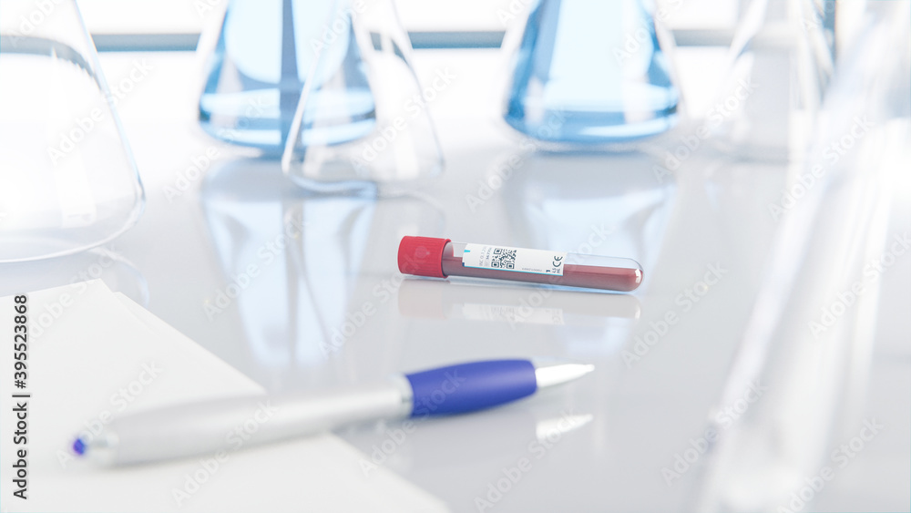 EDTA Blutproben Röhrchen in Labor mit Erlenmeyerkolben im Hintergrund EDTA Blutproben Röhrchen in Labor mit Erlenmeyerkolben im Hintergrund