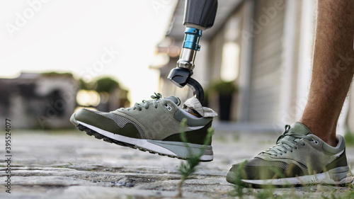 Low angle view at disabled young man with prosthetic leg walking along the street. Space for text