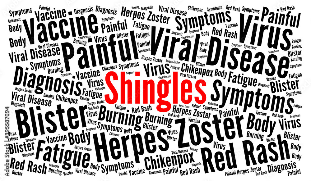 Shingles word cloud concept Shingles word cloud concept