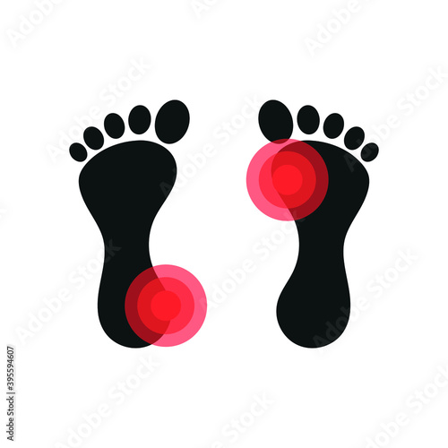 Vector image. Icon of a foot with localized pain.
