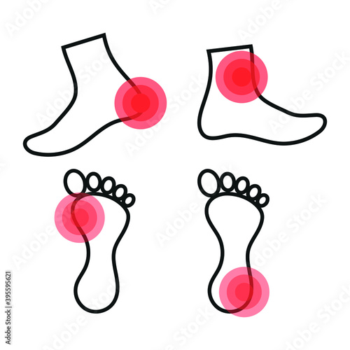 Vector image. Icon of a foot with localized pain.