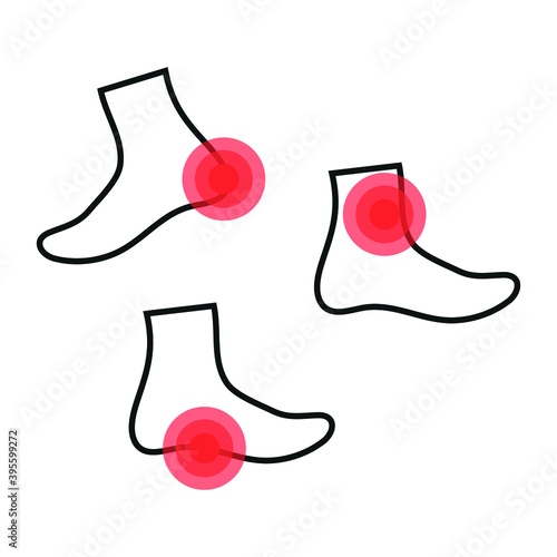 Vector image. Icon of a foot with localized pain.