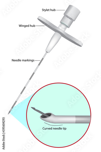 Tuohy Epidural Needle. Epidural administration Vector illustration