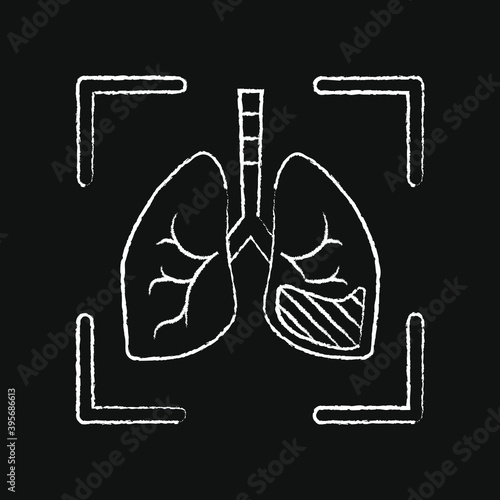 snapshot of inflamed lungs, chalk icon