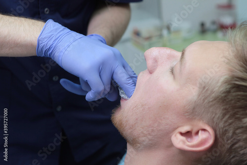 The dentist makes a cast of the patient's teeth. A young man at a doctor's appointment. Hands in protective gloves.
