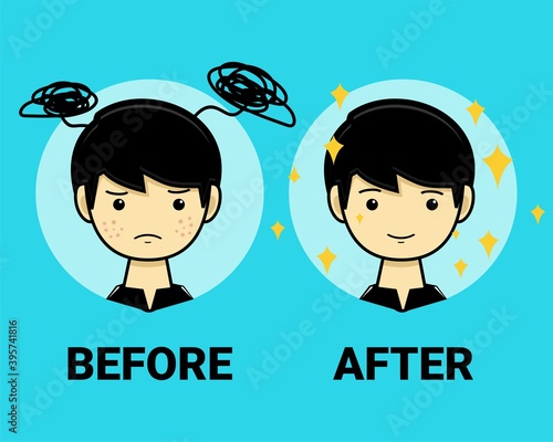 Acne in men. Before and after. Illustration vector