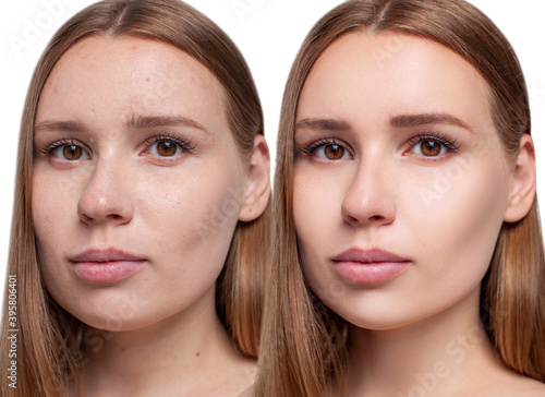 Face of beautiful woman before and after skin retouch. Beautician concept.