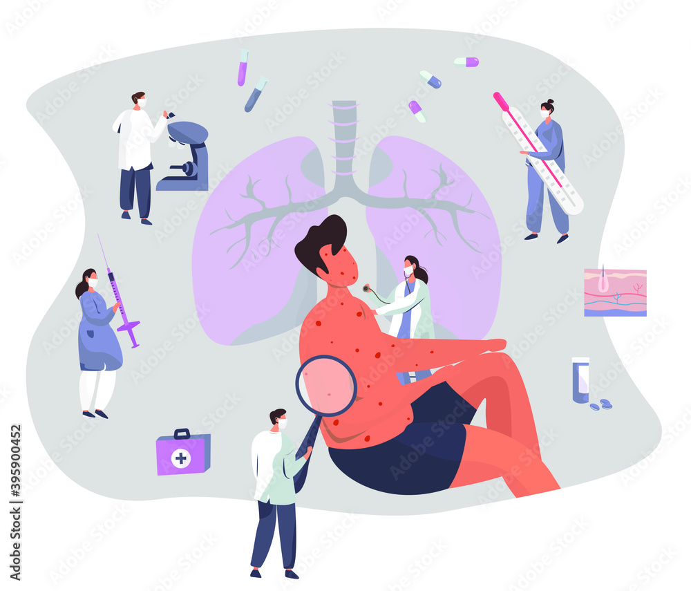 Skin Disease and Pimples.Diagnostics Dermatology.Skin Treatment.Allergy Symptoms or Chicken Pox Varicella with Itching.Doctor with Medical Equipment Looking on Pimples at Character.Vector Illustration
