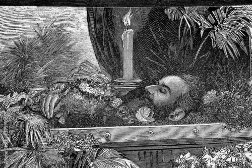 Hans Makart in his deathbed. Austrian painter, draughtsman, designer and decorator. 1840-1884. Antique illustration. 1884. photo