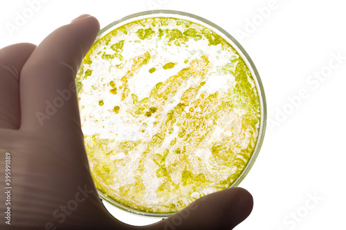 Petri dish with green bacteria. Medical tests and research