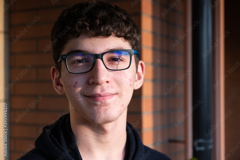 Portrait of a caicasic boy in puberty: on the skin of the face we can recognize small pimples, red spots, acne. Portrait of a caicasic boy in puberty: on the skin of the face we can recognize small pimples, red spots, acne.