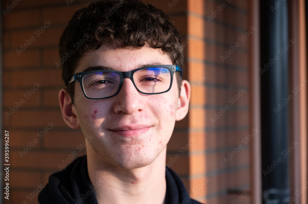 Portrait of a caicasic boy in puberty: on the skin of the face we can recognize small pimples, red spots, acne. Portrait of a caicasic boy in puberty: on the skin of the face we can recognize small pimples, red spots, acne.