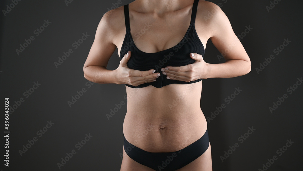 Close-up view of beautiful breasts in a sports bra, slim woman body in black underwear inover gray background. Diastasis of the abdominal muscles Close-up view of beautiful breasts in a sports bra, slim woman body in black underwear inover gray background. Diastasis of the abdominal muscles