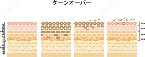 肌のターンオーバー