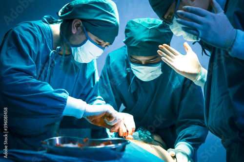 Surgical team or doctor and staff have vivisection in surgery room of the hospital and using equipment tool for the operation