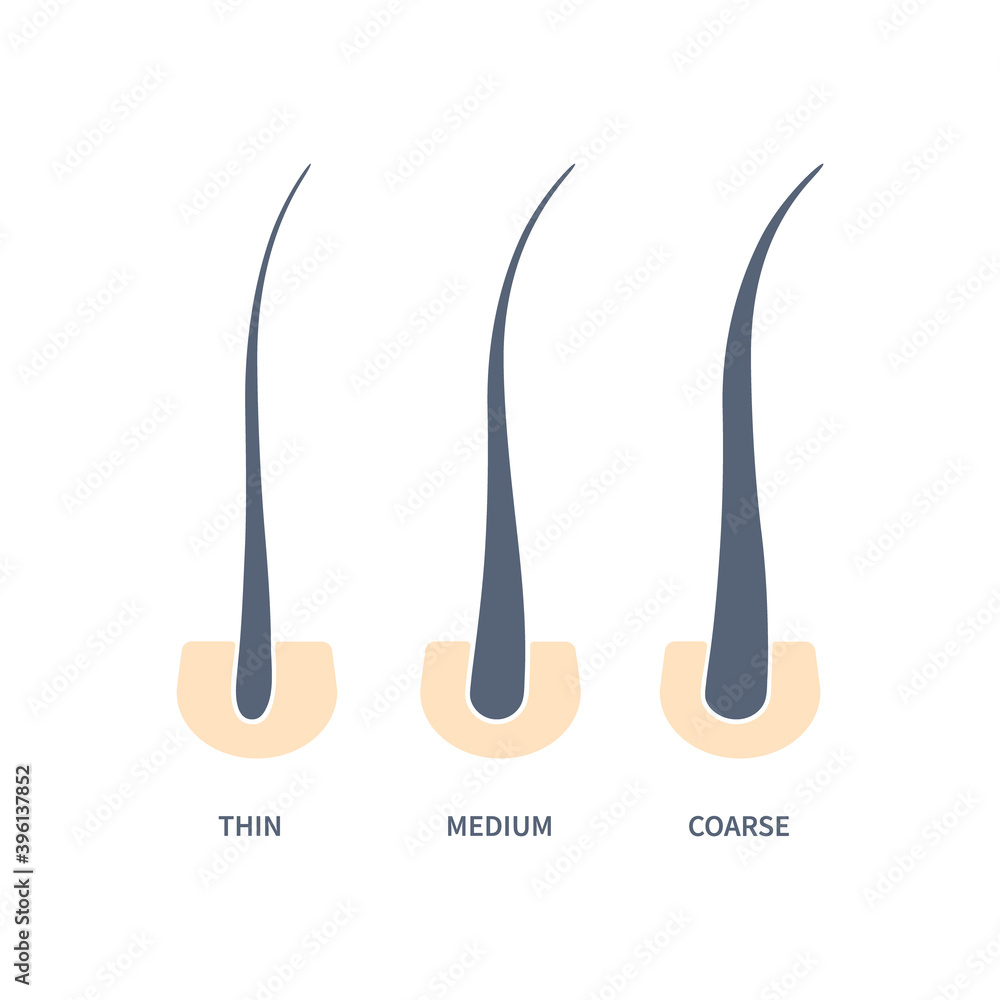 Hair thickness types in skin cross-section diagram Stock Vector | Adobe Stock Hair thickness types in skin cross-section diagram Stock Vector | Adobe Stock