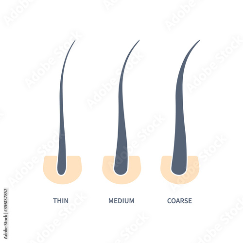 Hair thickness types in skin cross-section diagram